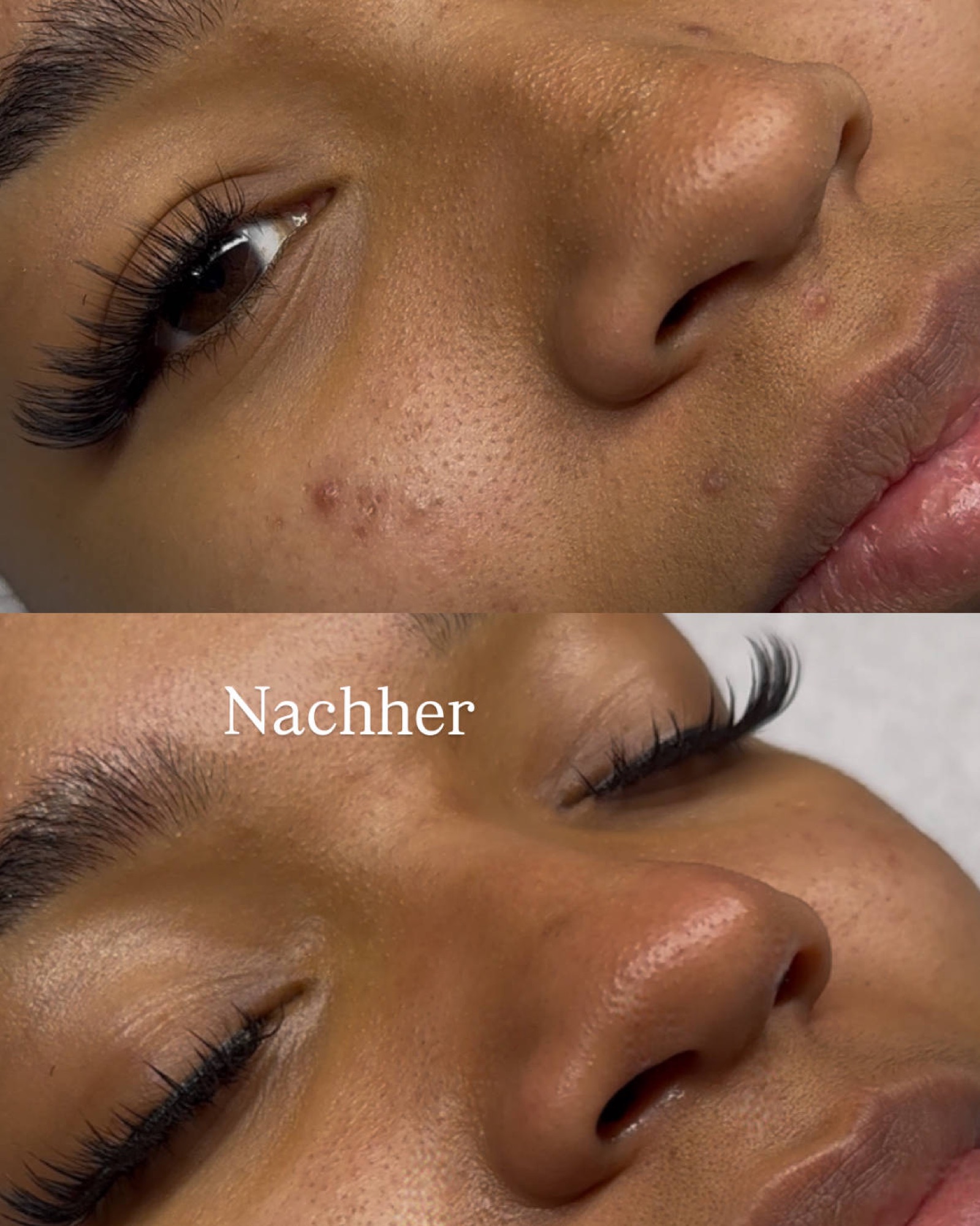 SaGlowFacial – Eindruck 1